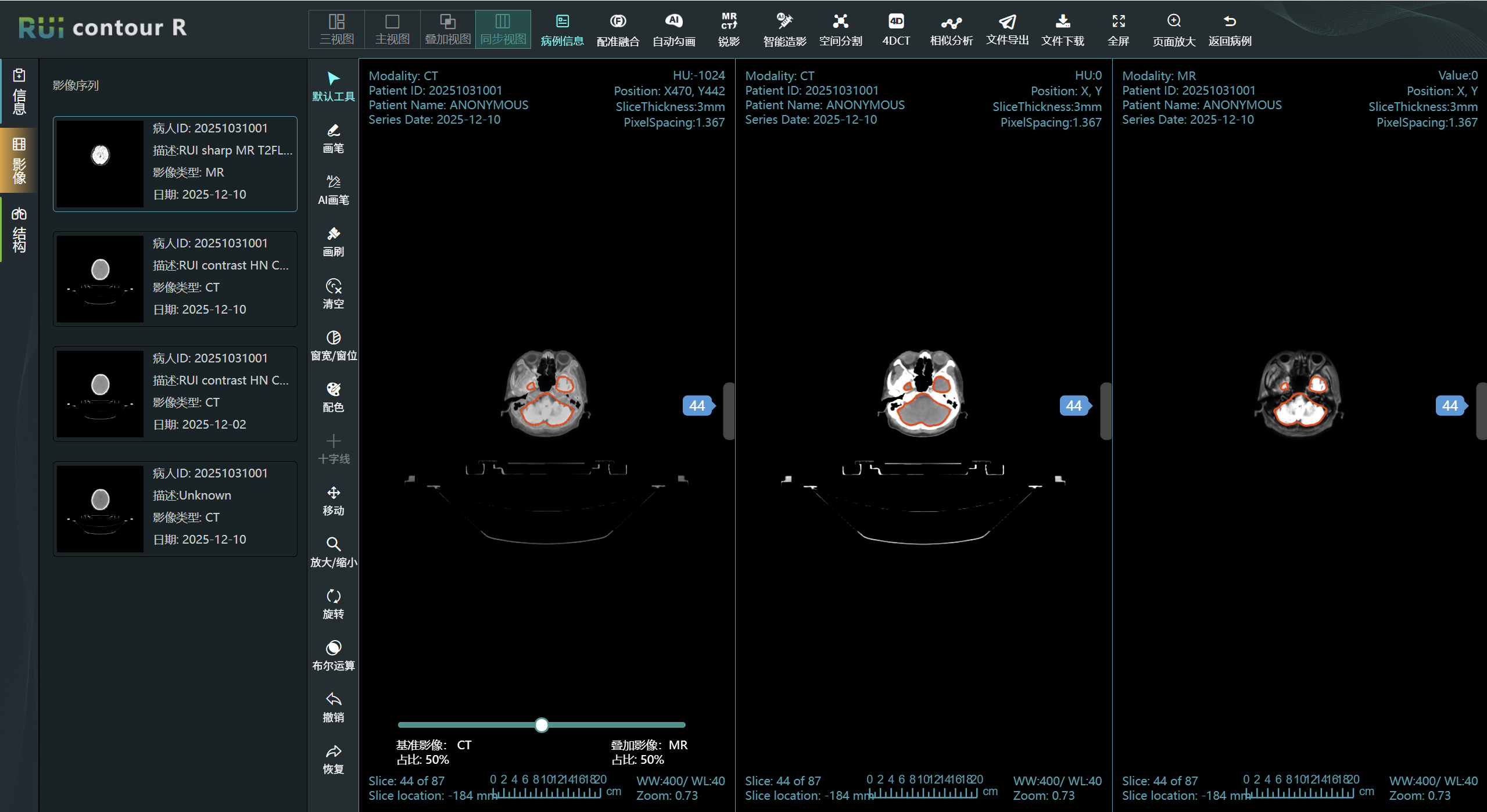RUI Contour M 登录界面