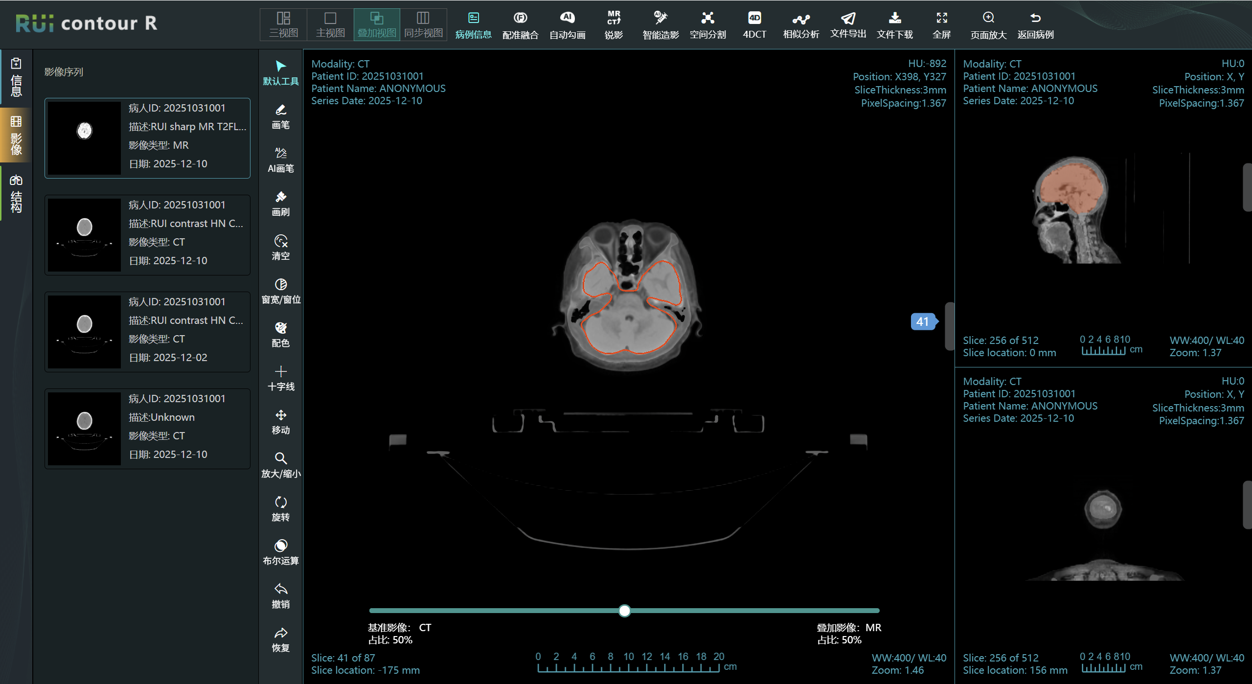 RUI Contour M 工作界面